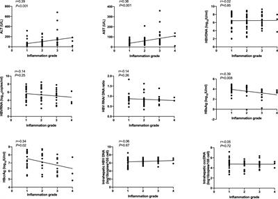 Serum HBsAg and HBcrAg is associated with inflammation in HBeAg-positive chronic hepatitis B patients